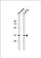 Protein HEXIM2 antibody, PA5-72301, Invitrogen Antibodies, Western Blot image 