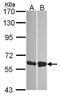 DEAD-Box Helicase 19B antibody, NBP2-16127, Novus Biologicals, Western Blot image 