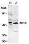 ZIPK antibody, SP1242P, Origene, Western Blot image 