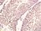 Coiled-Coil Domain Containing 54 antibody, orb2527, Biorbyt, Immunohistochemistry paraffin image 