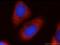 FMR1 Autosomal Homolog 1 antibody, 13194-1-AP, Proteintech Group, Immunofluorescence image 