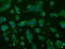 ATP Synthase F1 Subunit Beta antibody, GTX84843, GeneTex, Immunofluorescence image 