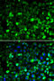 Ribosomal Protein Lateral Stalk Subunit P1 antibody, MBS9127167, MyBioSource, Immunofluorescence image 