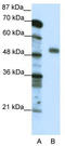 Nuclear Transcription Factor Y Subunit Gamma antibody, TA330041, Origene, Western Blot image 