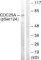 Cell Division Cycle 25A antibody, LS-C198774, Lifespan Biosciences, Western Blot image 