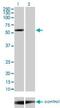YES Proto-Oncogene 1, Src Family Tyrosine Kinase antibody, H00007525-M01, Novus Biologicals, Western Blot image 