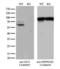 SS18 Subunit Of BAF Chromatin Remodeling Complex antibody, LS-C795186, Lifespan Biosciences, Western Blot image 
