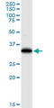 Eukaryotic Translation Elongation Factor 1 Delta antibody, LS-C197110, Lifespan Biosciences, Western Blot image 