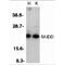 CASP2 And RIPK1 Domain Containing Adaptor With Death Domain antibody, TA305943, Origene, Western Blot image 