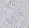 Retinoic Acid Receptor Alpha antibody, FNab07120, FineTest, Immunohistochemistry paraffin image 