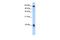 Protein S100-A3 antibody, GTX47086, GeneTex, Western Blot image 