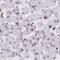 Nuclear Autoantigenic Sperm Protein antibody, PA5-56494, Invitrogen Antibodies, Immunohistochemistry frozen image 