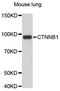 Catenin Beta 1 antibody, LS-C747187, Lifespan Biosciences, Western Blot image 