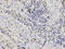 SH2 Domain Containing 1A antibody, LS-B14856, Lifespan Biosciences, Immunohistochemistry frozen image 