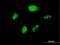 Bystin Like antibody, H00000705-B02P, Novus Biologicals, Immunocytochemistry image 