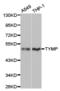 Thymidine Phosphorylase antibody, TA326922, Origene, Western Blot image 