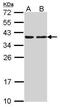 Capping Actin Protein Of Muscle Z-Line Subunit Alpha 2 antibody, PA5-29982, Invitrogen Antibodies, Western Blot image 