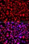 Chitobiosyldiphosphodolichol beta-mannosyltransferase antibody, LS-C409367, Lifespan Biosciences, Immunofluorescence image 