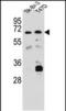 Carboxylesterase 4A antibody, PA5-48484, Invitrogen Antibodies, Western Blot image 