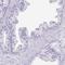 Dickkopf Like Acrosomal Protein 1 antibody, NBP2-48868, Novus Biologicals, Immunohistochemistry paraffin image 