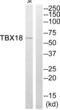 T-Box 18 antibody, abx014936, Abbexa, Western Blot image 