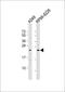 5',3'-Nucleotidase, Mitochondrial antibody, 61-330, ProSci, Western Blot image 