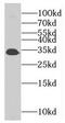 Melanoma-associated antigen 4 antibody, FNab04938, FineTest, Western Blot image 