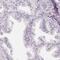Chromosome 1 Open Reading Frame 194 antibody, PA5-62026, Invitrogen Antibodies, Immunohistochemistry frozen image 