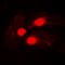 Bruton Tyrosine Kinase antibody, LS-C353914, Lifespan Biosciences, Immunofluorescence image 