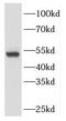 FGFR1 Oncogene Partner antibody, FNab03100, FineTest, Western Blot image 