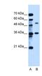Transmembrane Protein 8B antibody, NBP1-60059, Novus Biologicals, Western Blot image 