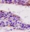 Autoimmunogenic cancer/testis antigen NY-ESO-2 antibody, orb101530, Biorbyt, Immunohistochemistry paraffin image 