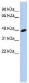 ADP Ribosylation Factor Like GTPase 13B antibody, TA340376, Origene, Western Blot image 