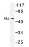 Protein kinase B antibody, AP20342PU-N, Origene, Western Blot image 