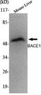 Beta-Secretase 1 antibody, STJ98471, St John