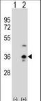 Collectin-11 antibody, LS-C166932, Lifespan Biosciences, Western Blot image 
