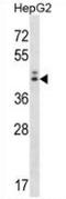 Neuroguidin antibody, AP52870PU-N, Origene, Western Blot image 