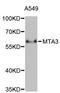 Metastasis-associated protein MTA3 antibody, A2328, ABclonal Technology, Western Blot image 