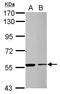 Zinc finger protein RFP antibody, GTX107805, GeneTex, Western Blot image 