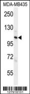 Zinc Finger CCCH-Type Containing 3 antibody, 55-566, ProSci, Western Blot image 