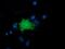 LRAT Domain Containing 2 antibody, GTX84525, GeneTex, Immunocytochemistry image 