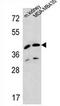 L-2-Hydroxyglutarate Dehydrogenase antibody, AP52435PU-N, Origene, Western Blot image 