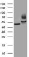 Fascin Actin-Bundling Protein 1 antibody, CF807295, Origene, Western Blot image 
