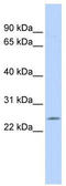 Proteasome Subunit Beta 5 antibody, TA342169, Origene, Western Blot image 