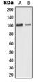 Glutamate Ionotropic Receptor AMPA Type Subunit 2 antibody, orb214008, Biorbyt, Western Blot image 