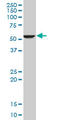 Fatty Acid Desaturase 1 antibody, LS-B6061, Lifespan Biosciences, Western Blot image 