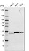 Purine Nucleoside Phosphorylase antibody, PA5-51616, Invitrogen Antibodies, Western Blot image 