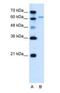 Solute carrier family 15 member 4 antibody, NBP1-59636, Novus Biologicals, Western Blot image 