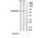 Calcium/Calmodulin Dependent Protein Kinase Kinase 2 antibody, TA315087, Origene, Western Blot image 