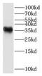 Hydroxy-Delta-5-Steroid Dehydrogenase, 3 Beta- And Steroid Delta-Isomerase 7 antibody, FNab04032, FineTest, Western Blot image 